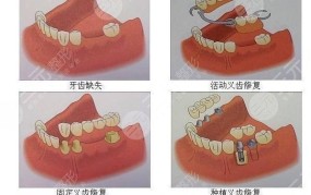 手术去痣价格是多少？有哪些影响价格的因素？